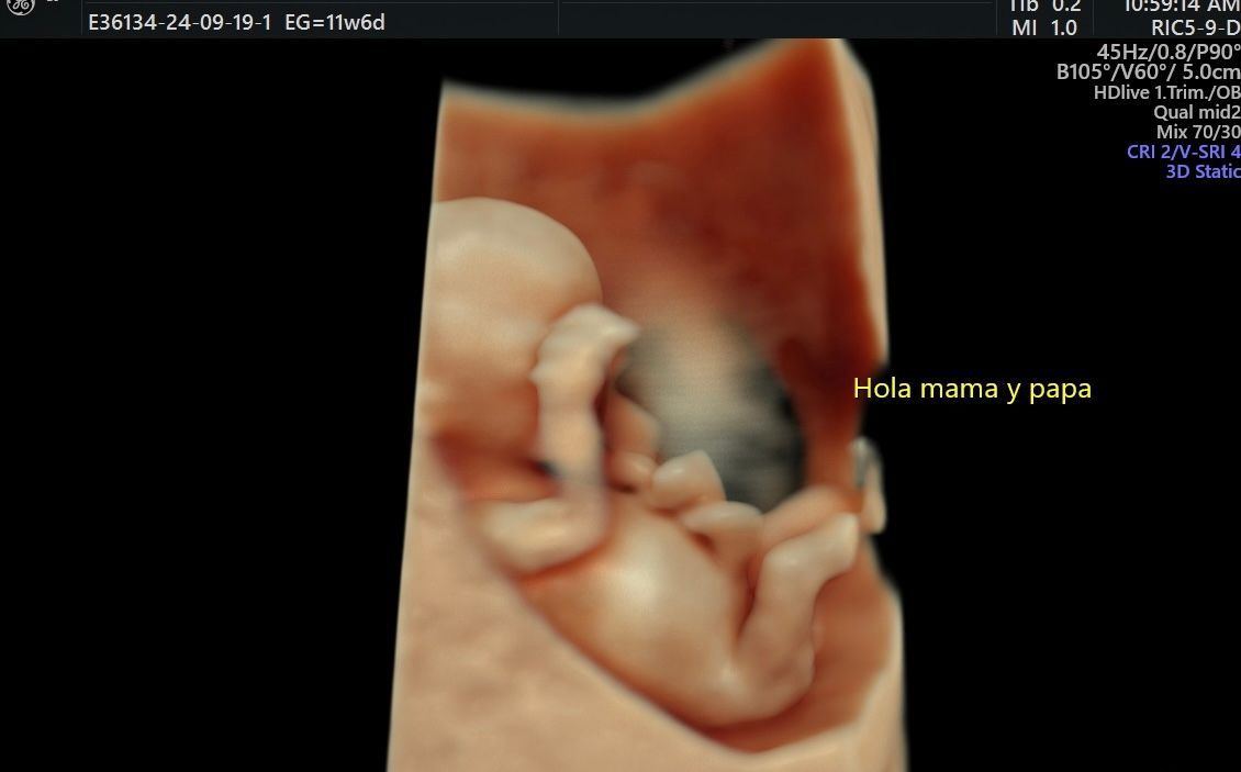 César Elí Cruz Ruiz-3