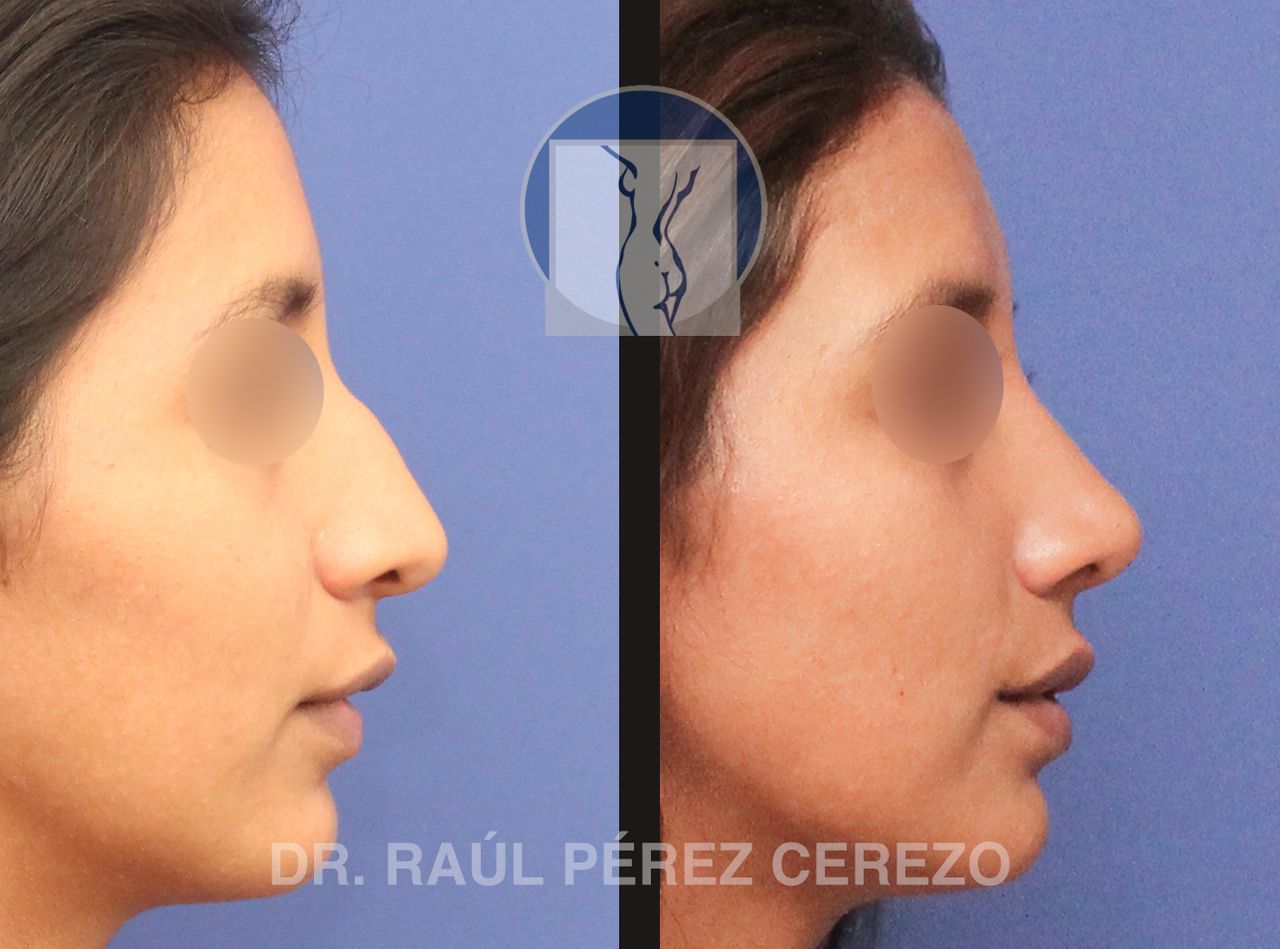 Raúl Pérez Cerezo-2