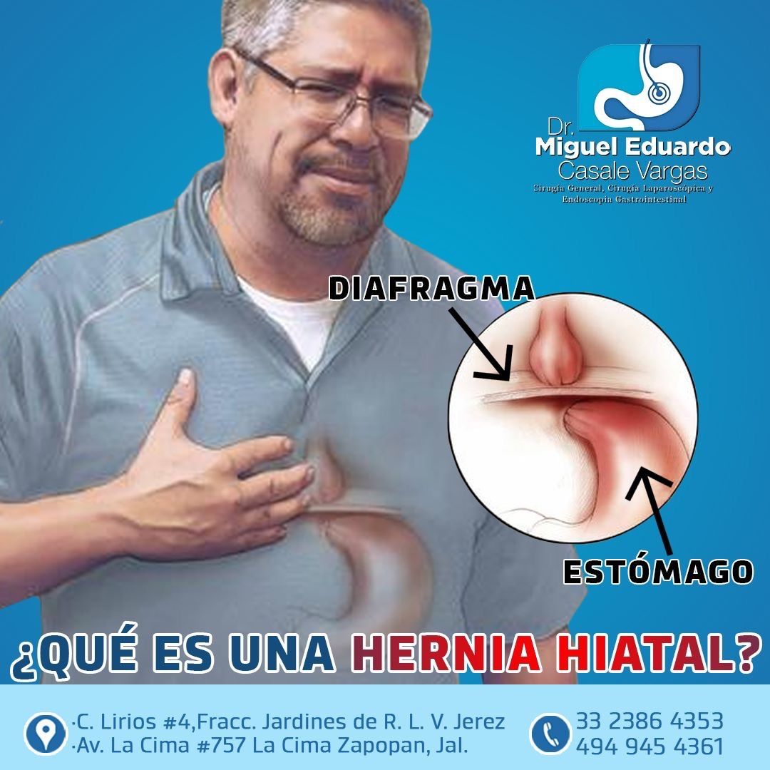 Miguel Eduardo Casale Vargas-38