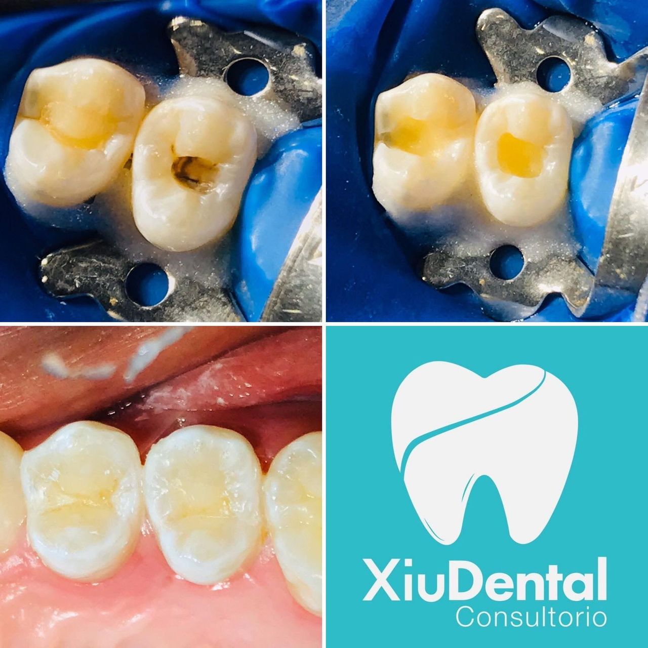 Xiuhnel Solorio Cuevas-7