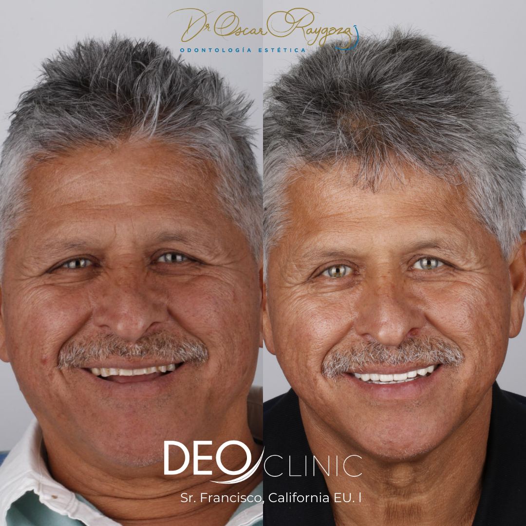 Oscar Raygoza Carrillo-22