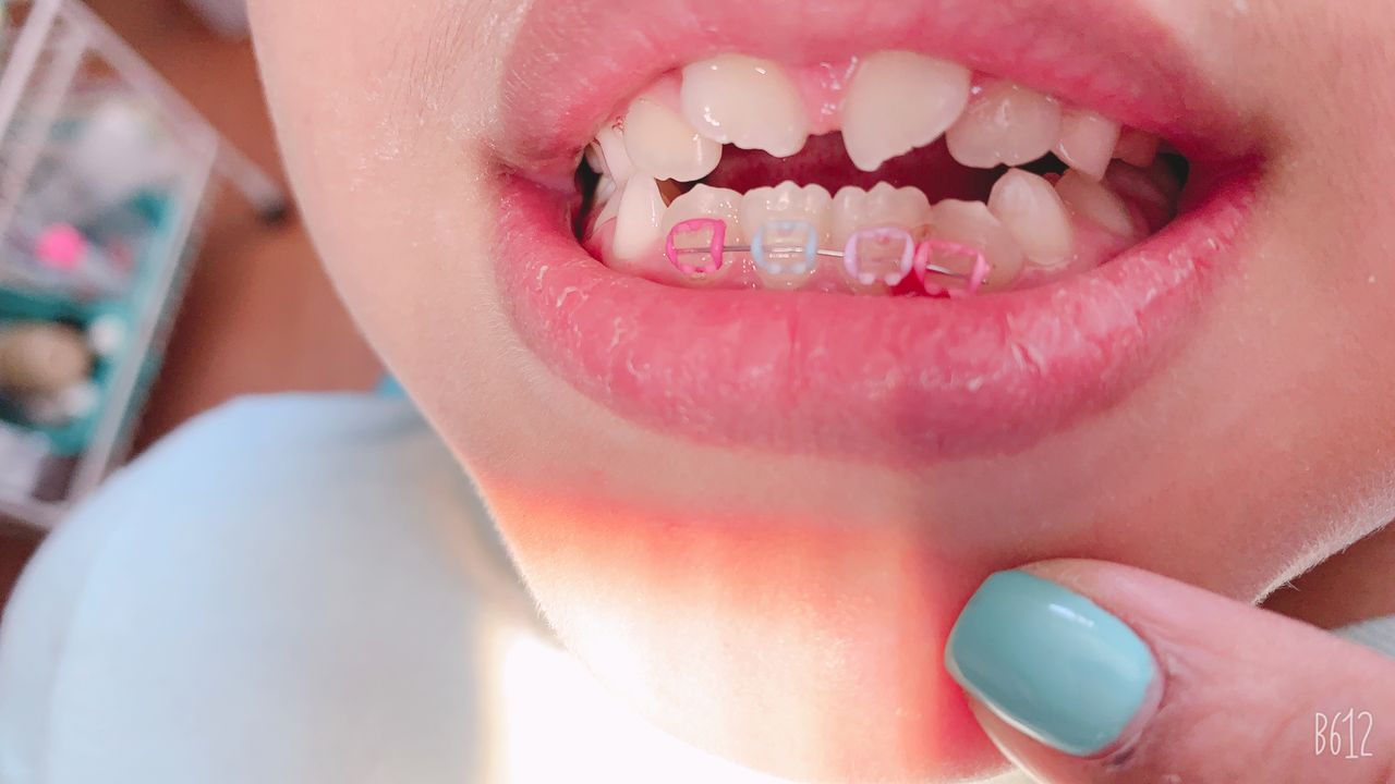 Mirely Peralta Rodríguez-2