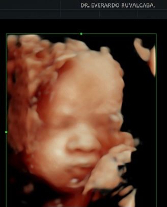 Everardo Ruvalcaba Rivera-3