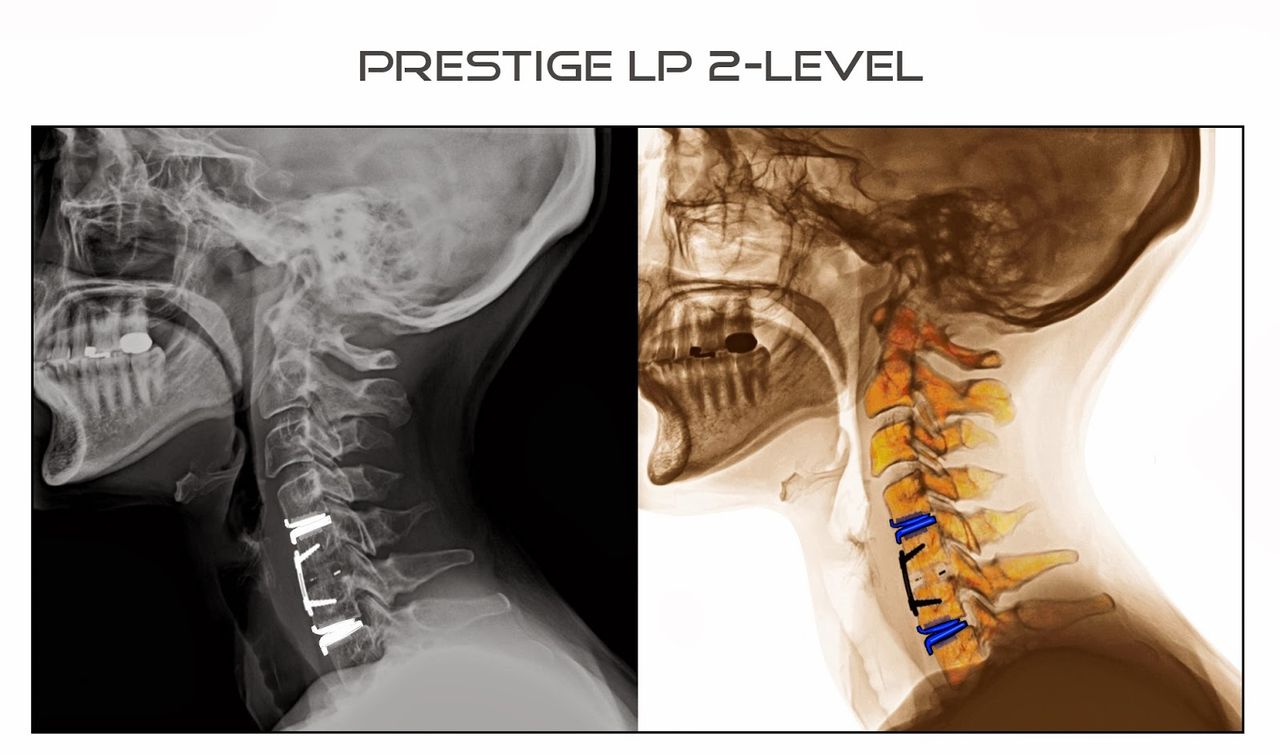José Sayavedra Jaimes-35