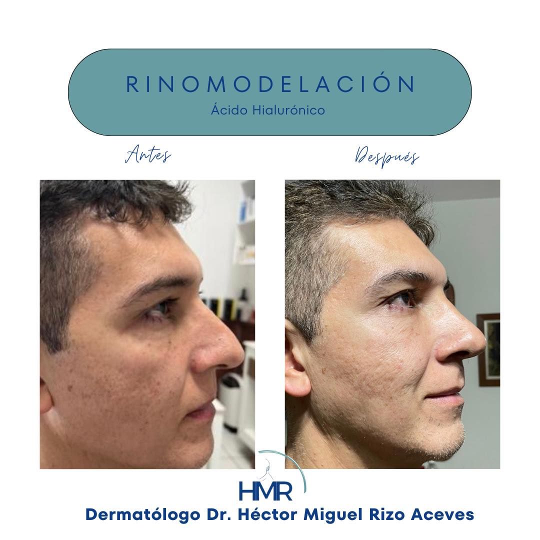 Hector Miguel Rizo Aceves-5