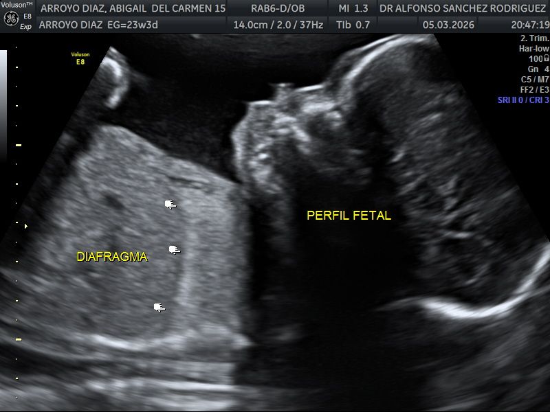 Alfonso Sanchez Rodriguez-60