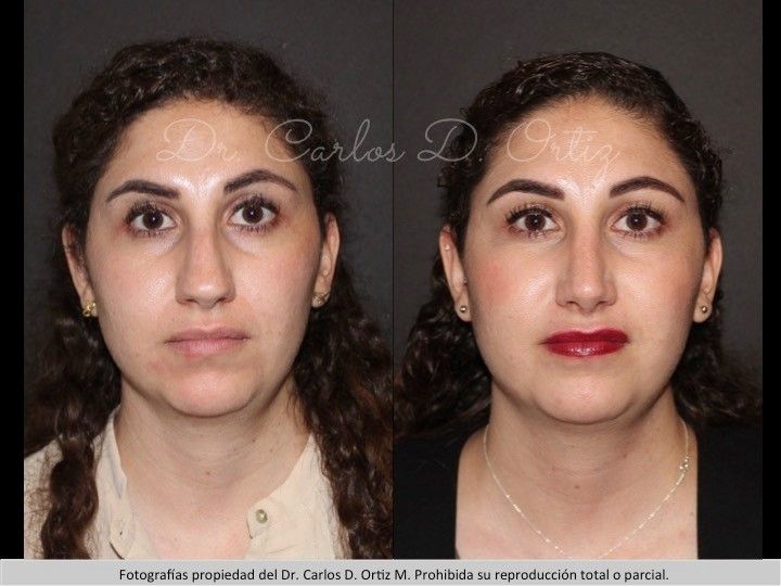 Carlos David Ortiz Moreno-22