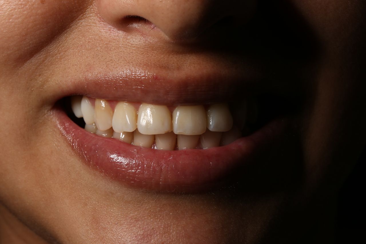 Oscar Alejandro Azcárate Tendilla-15