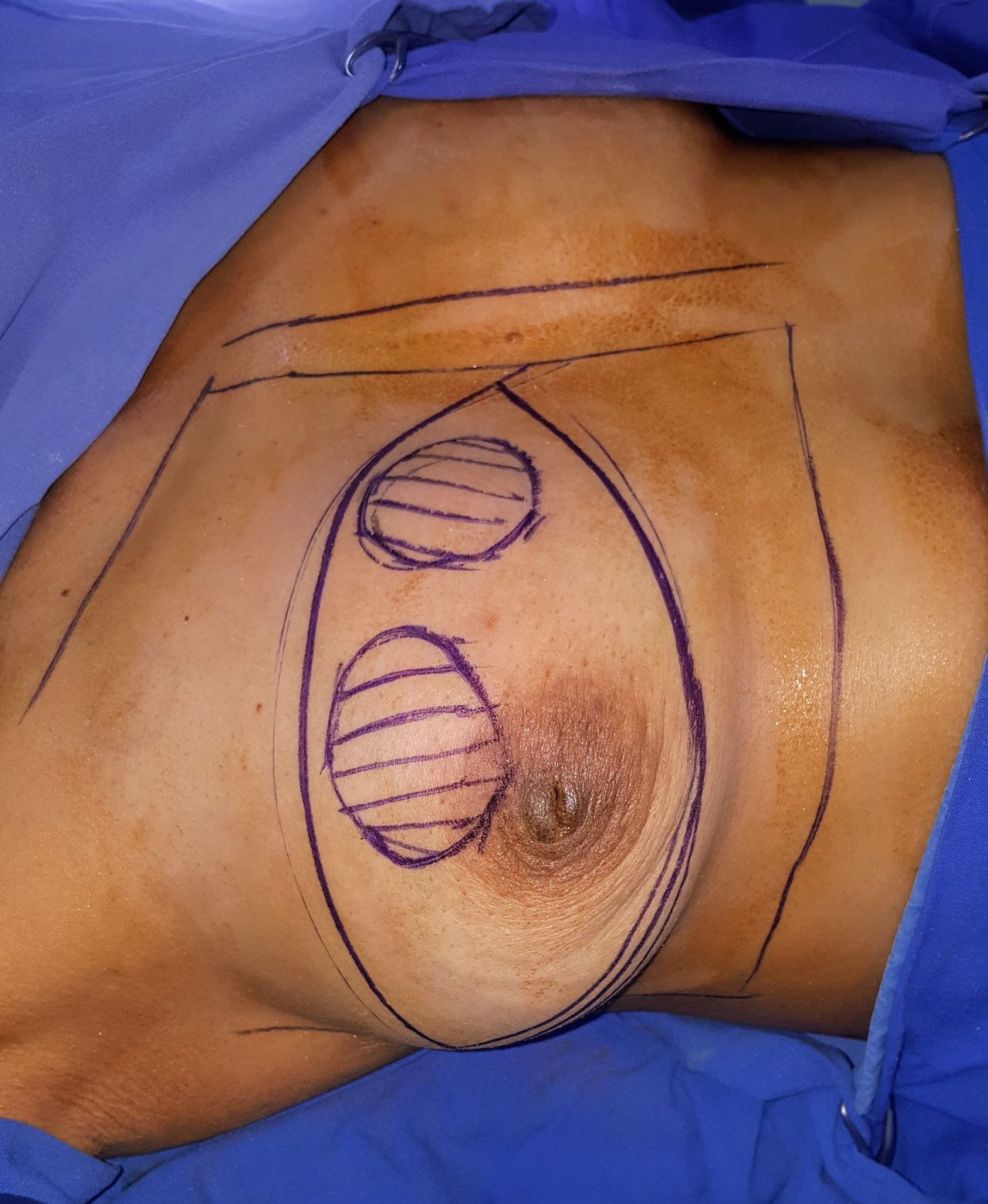 Ángel Millán Juárez-23