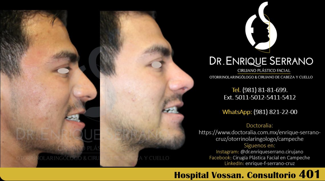 Enrique Serrano Cruz-97