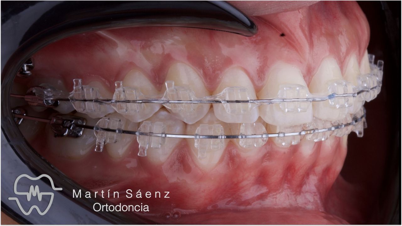 Martín Sáenz Zárate-15