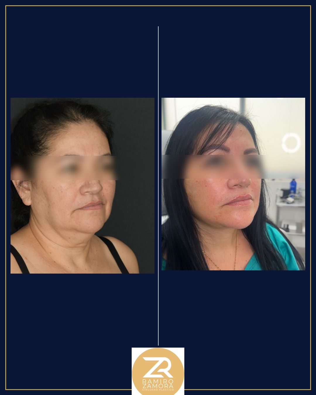 Ramiro Zamora Rodríguez-17