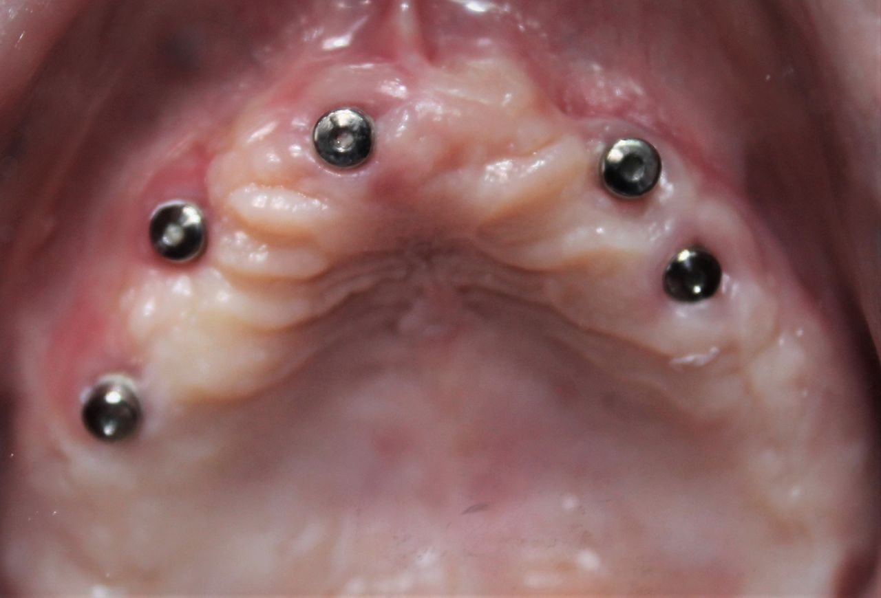 Aimee Valles Monárrez-45