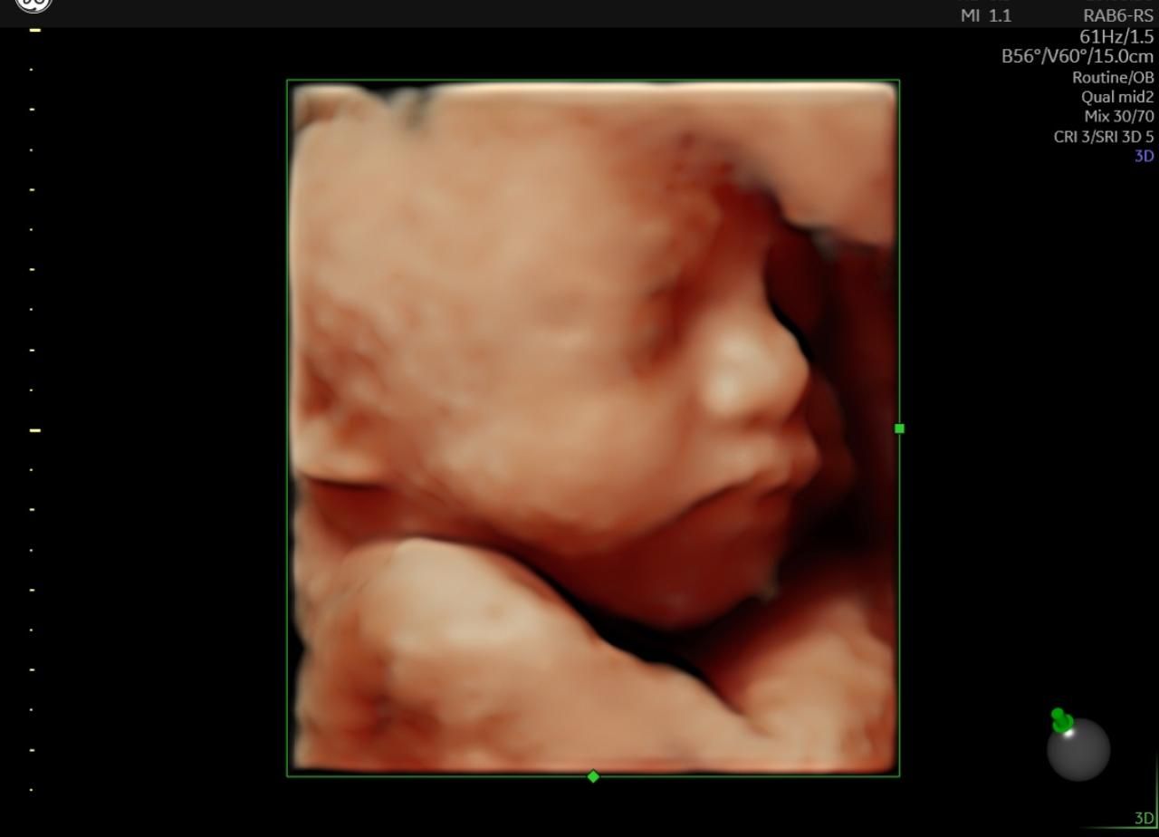 Martha Ivón Mondragón Cervantes-1