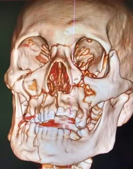 Luis Enrique Cruz Hernández-41