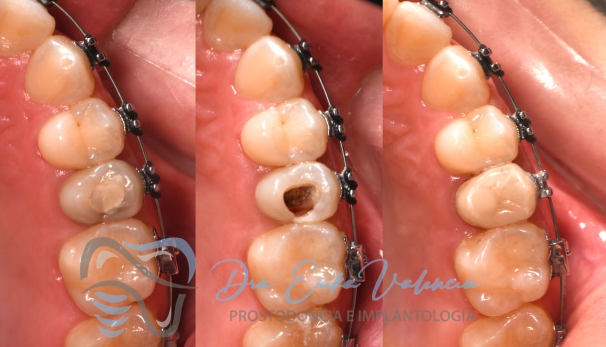 Erika Stephany Valencia Delgadillo-1