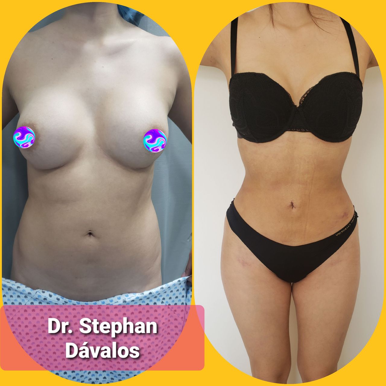 Stephan Dávalos Barrios-6