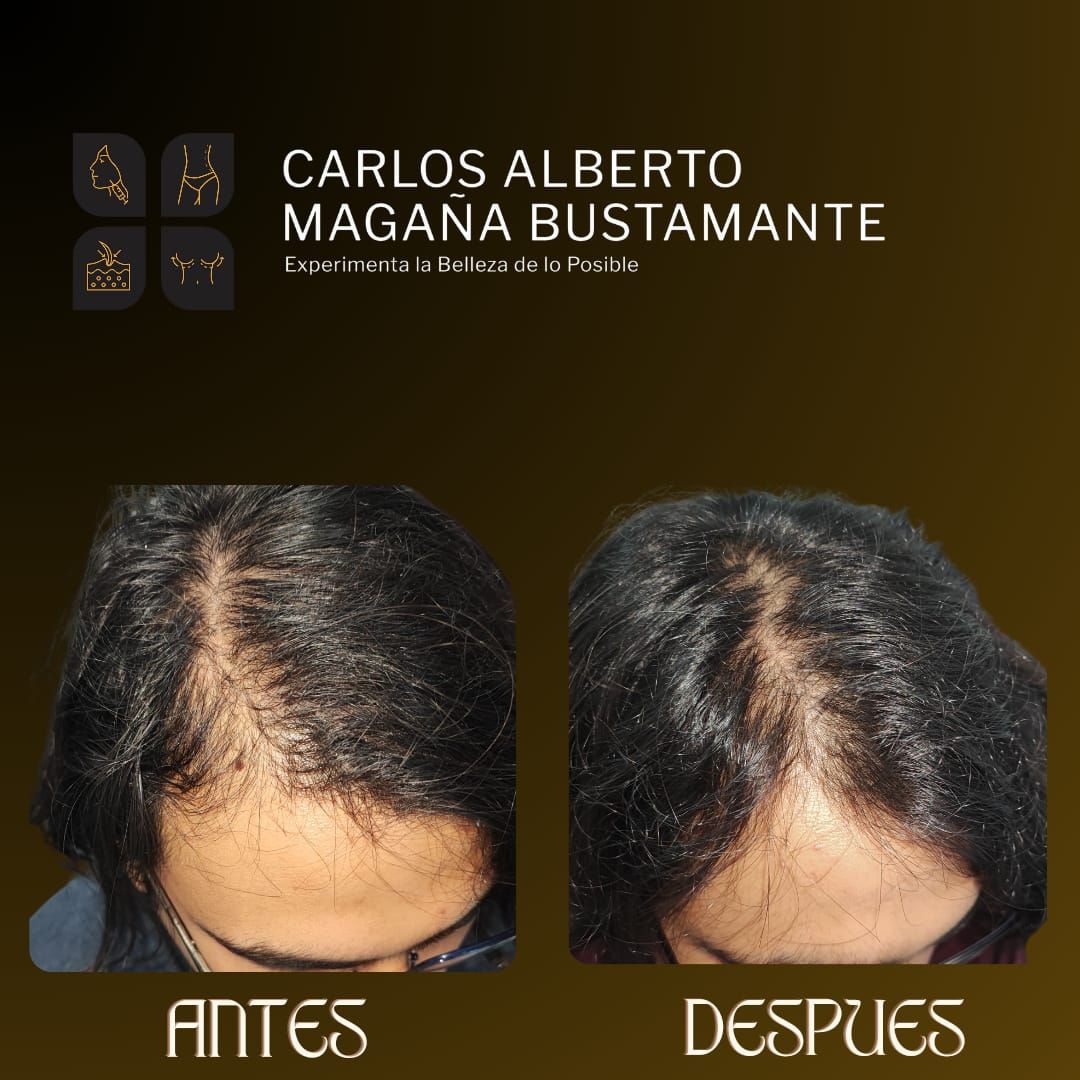 Carlos Alberto Magaña Bustamante-29