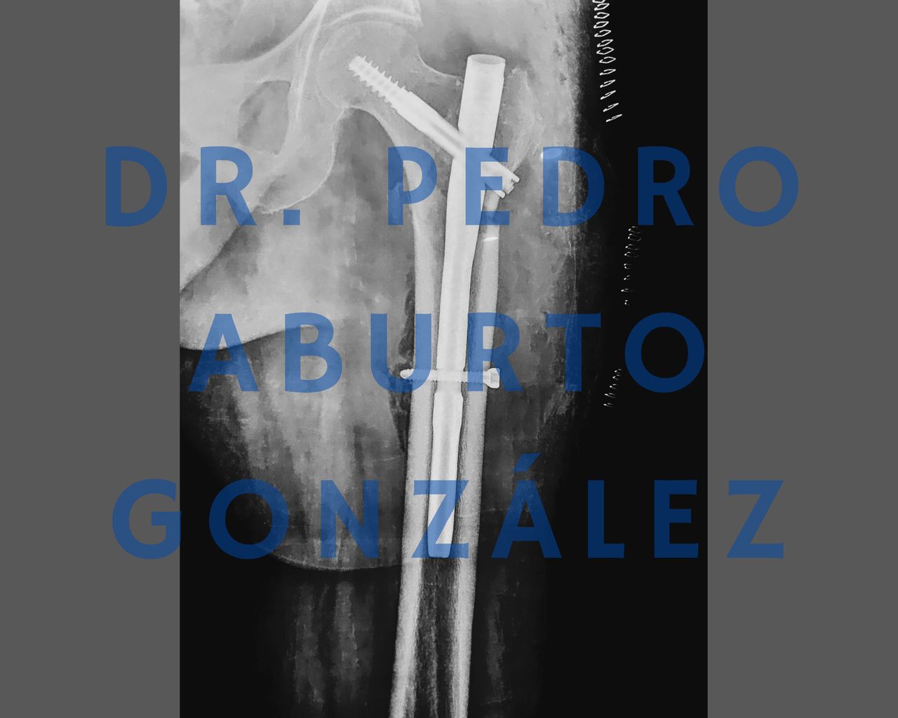 Pedro Aburto González-27