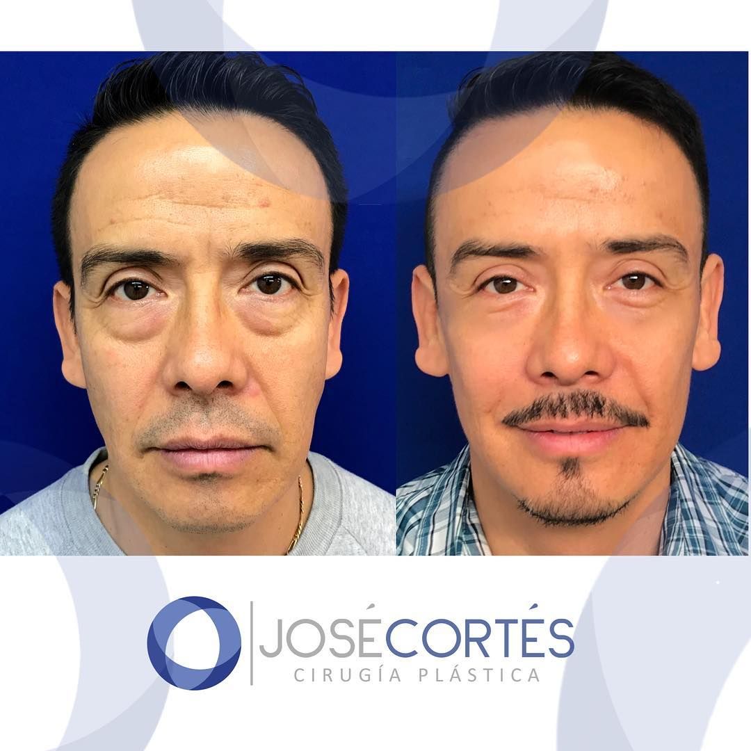 José Cortés Arreguin-14