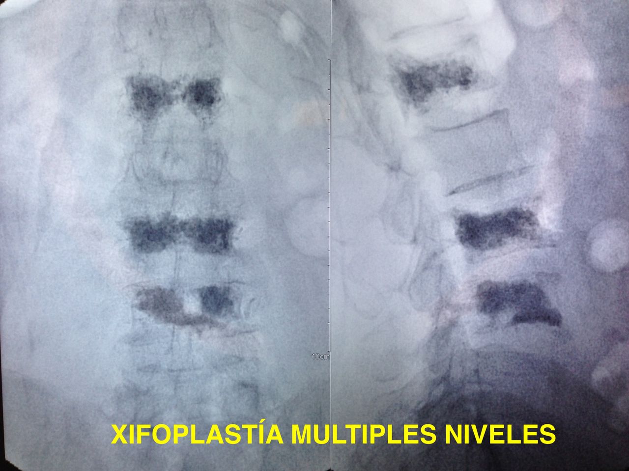 Jesus Rocha Maguey-22