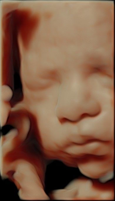 Nallely Moreno  Uribe-11