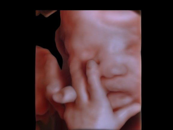 Rodolfo Antonio Gurrola Ochoa-3