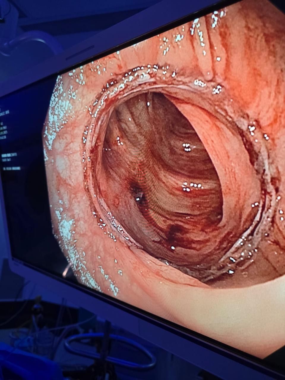 José De Jesús Nuñez Aguilar-7