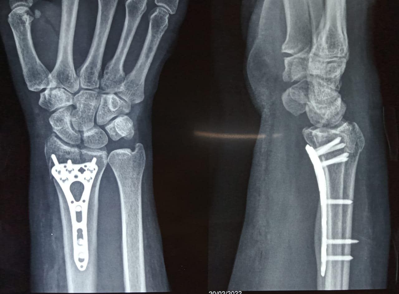 Felix Alfaro Arias-13