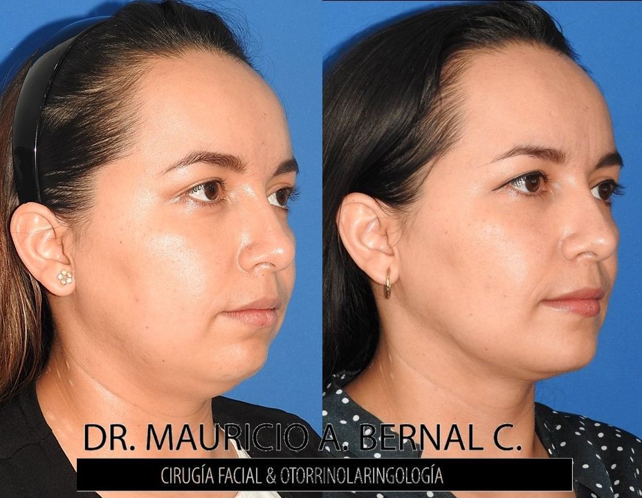 Mauricio Alejandro Bernal Carreon-13