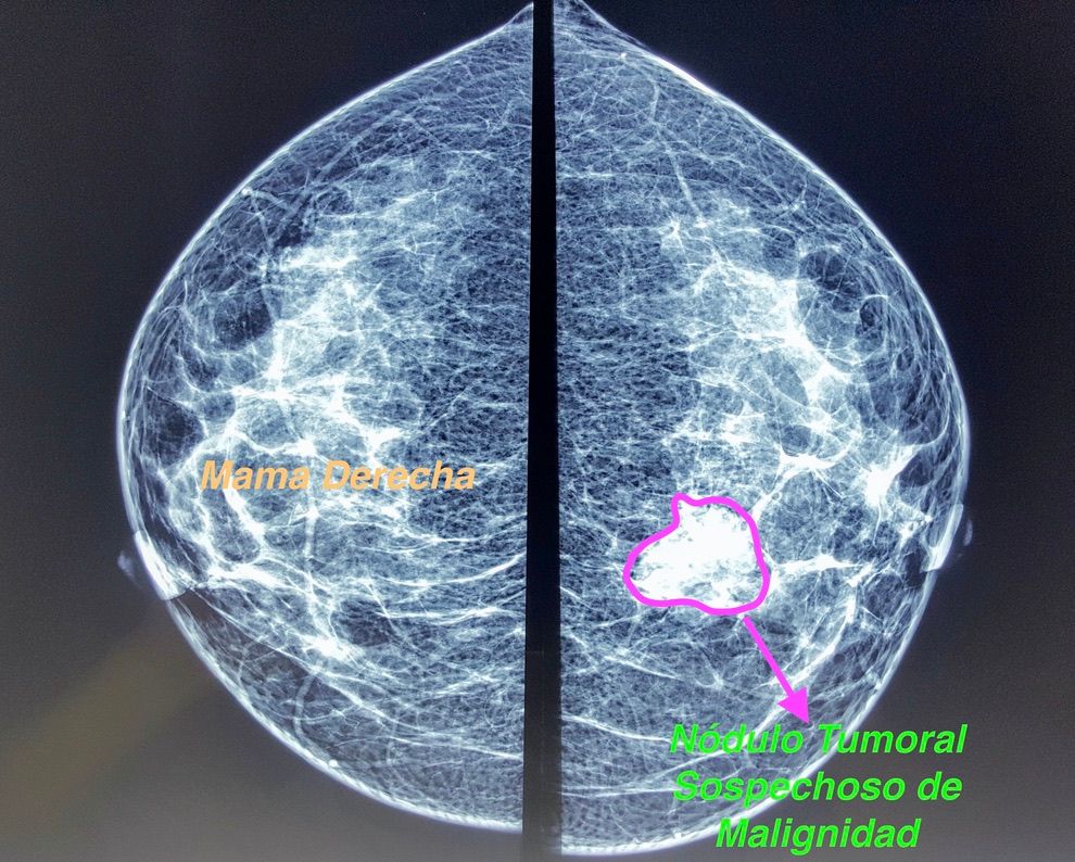 Ángel Millán Juárez-55