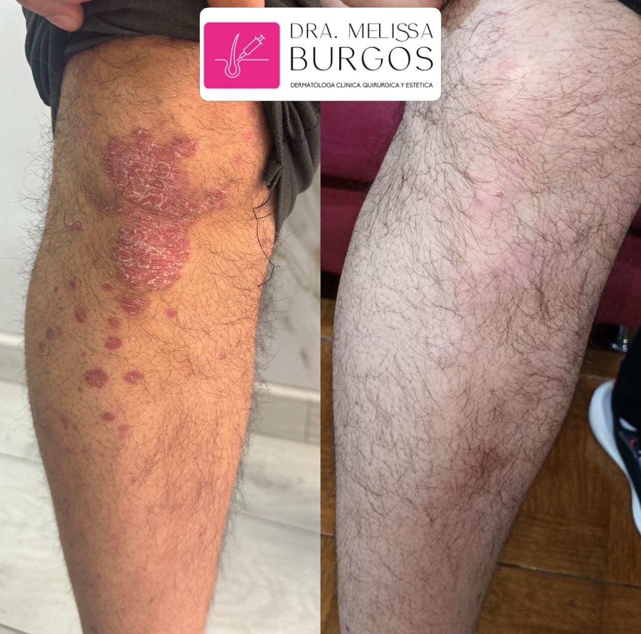 Melissa Burgos Romero-20