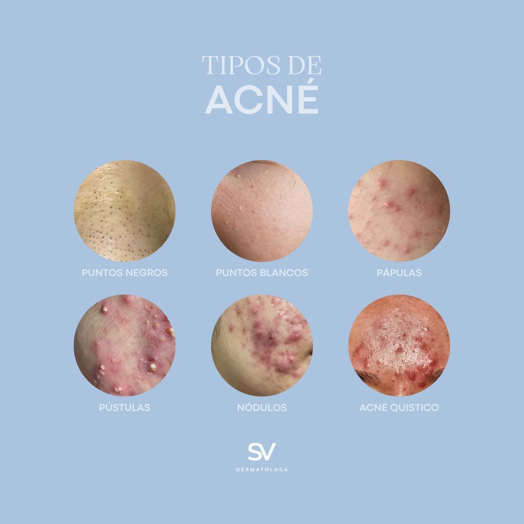 Sandra E. Vázquez Lares-6