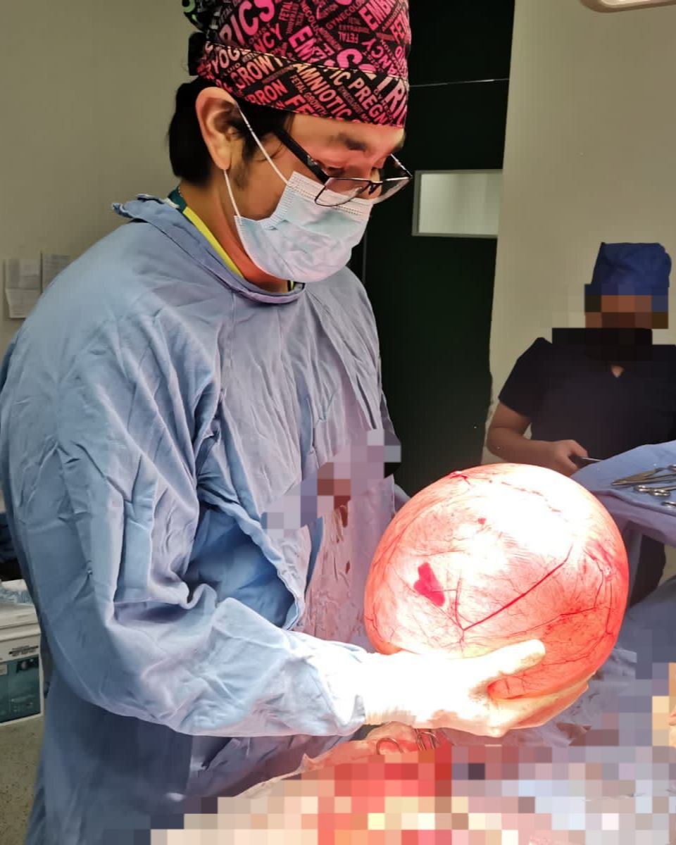 José Miguel Arano Acua-14