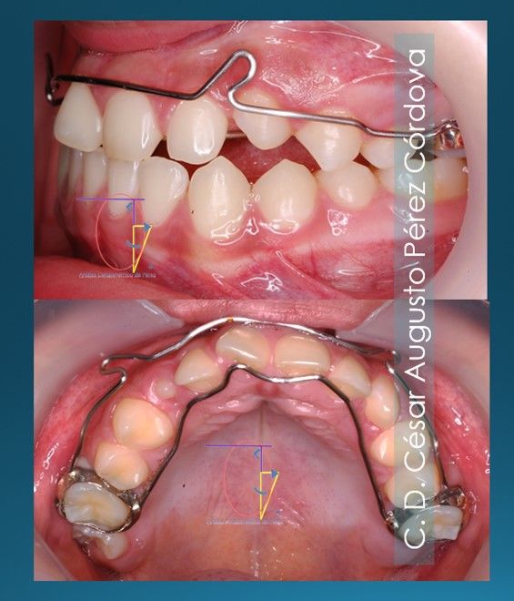 César Augusto Pérez Córdova-18