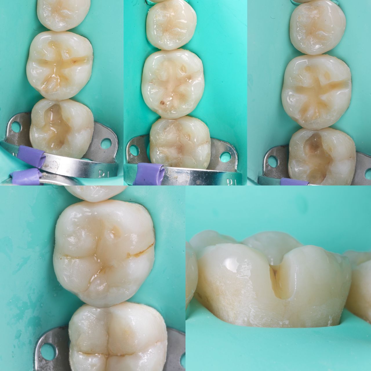 Hervin Eduardo Mendez Borrego-15