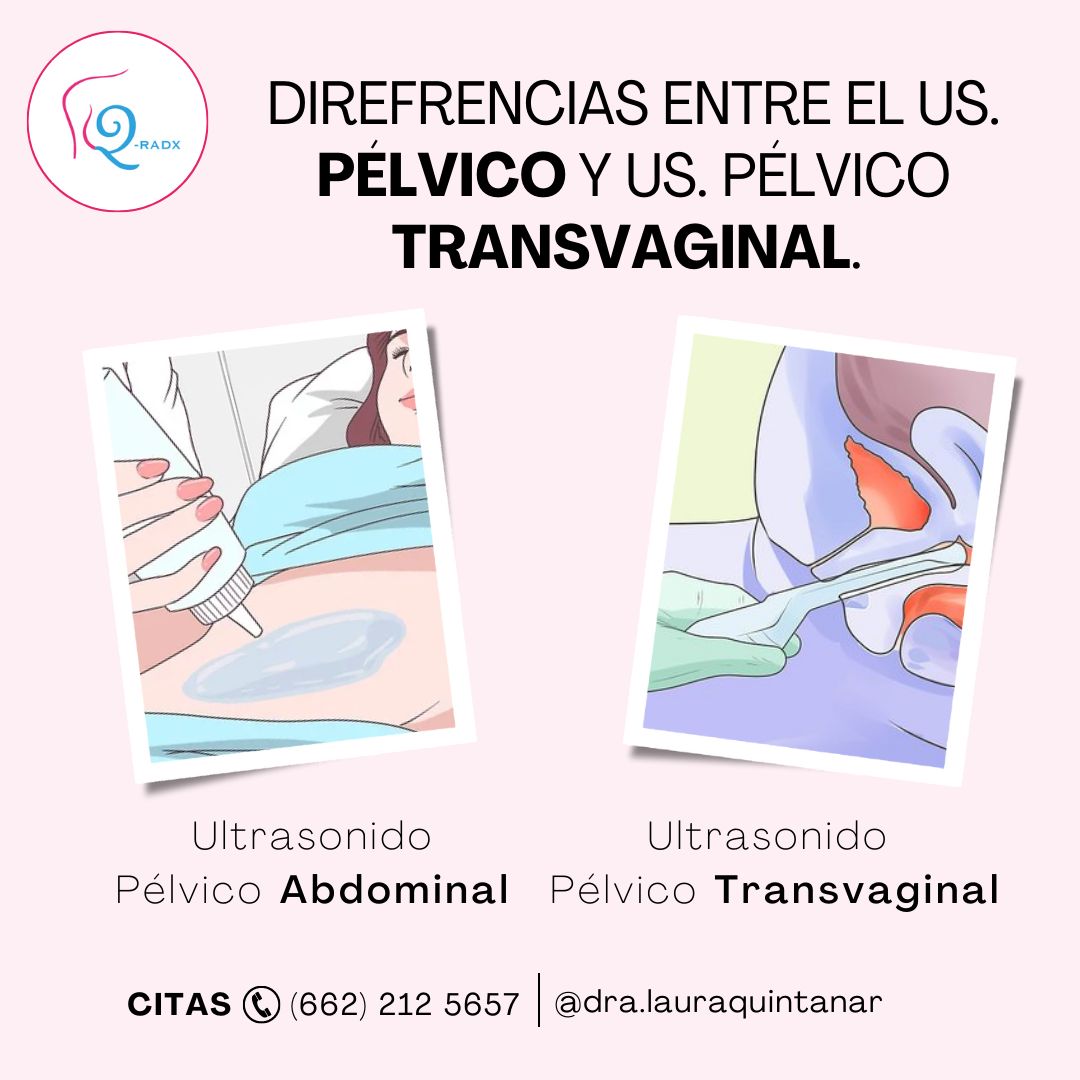 Laura Judith Quintanar Lugo-7