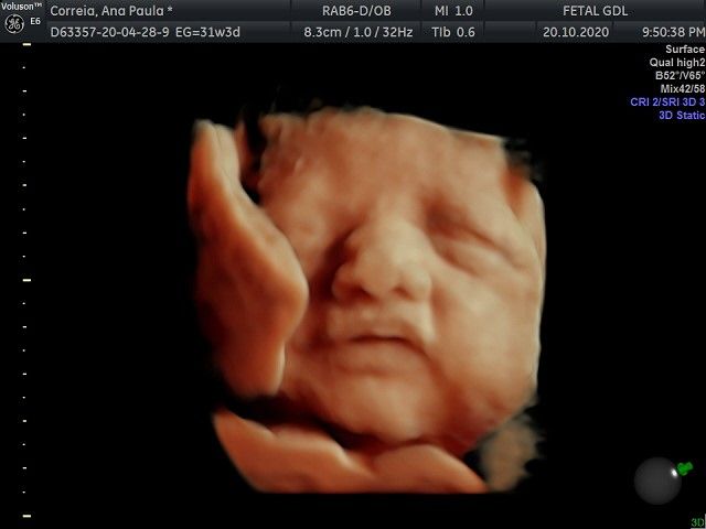 Arturo Herrera Flores-11