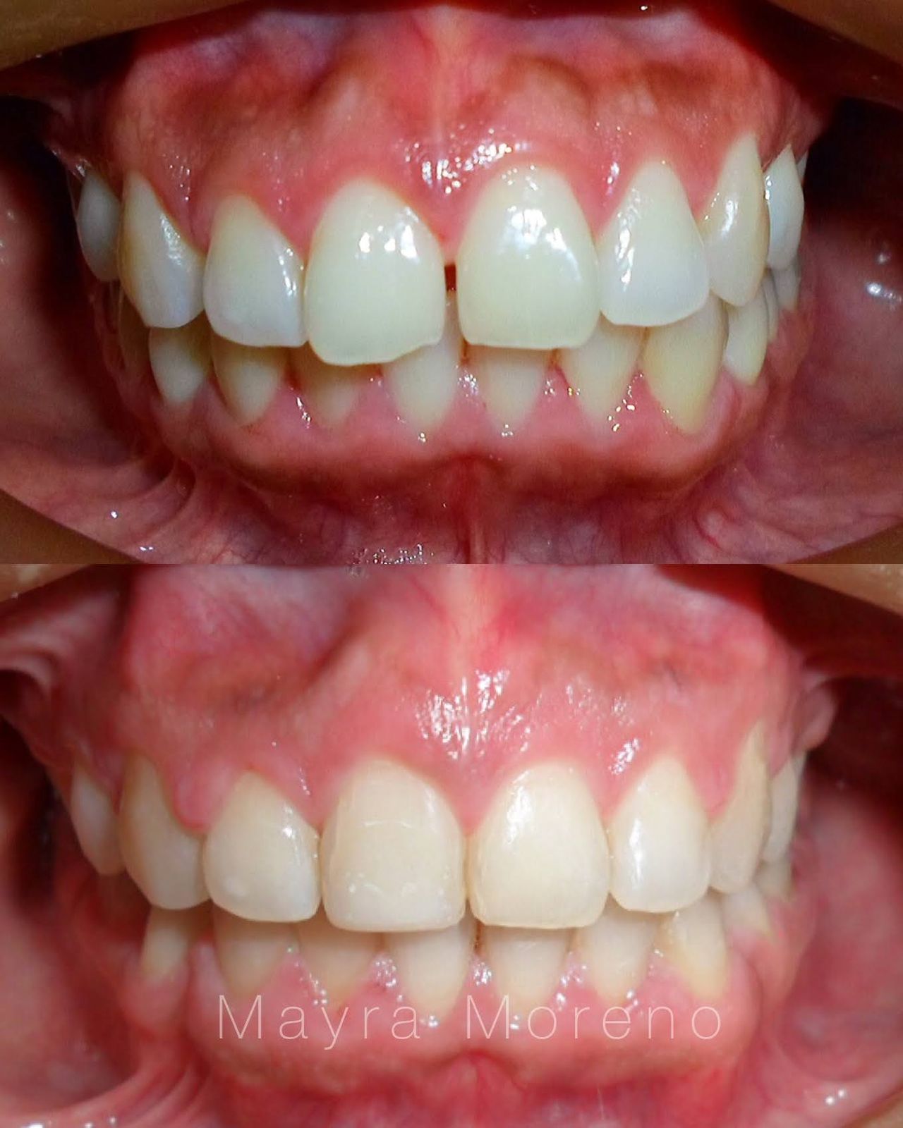 Mayra Moreno Rojas-8