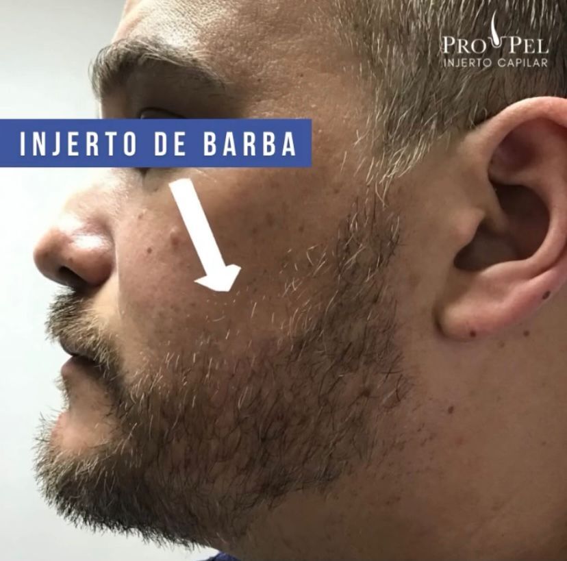 Karla Vanessa Becerra-29