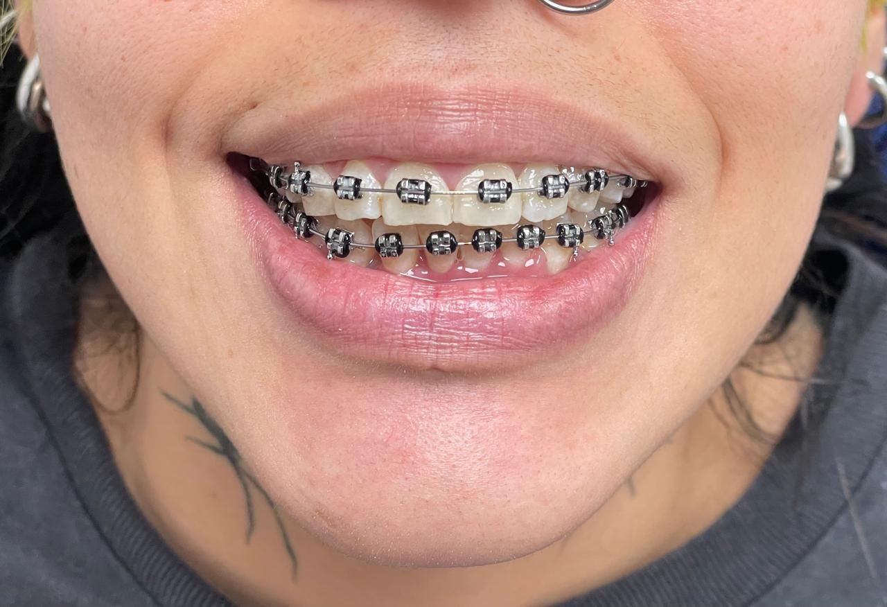 Anuar Becerril Castro-23