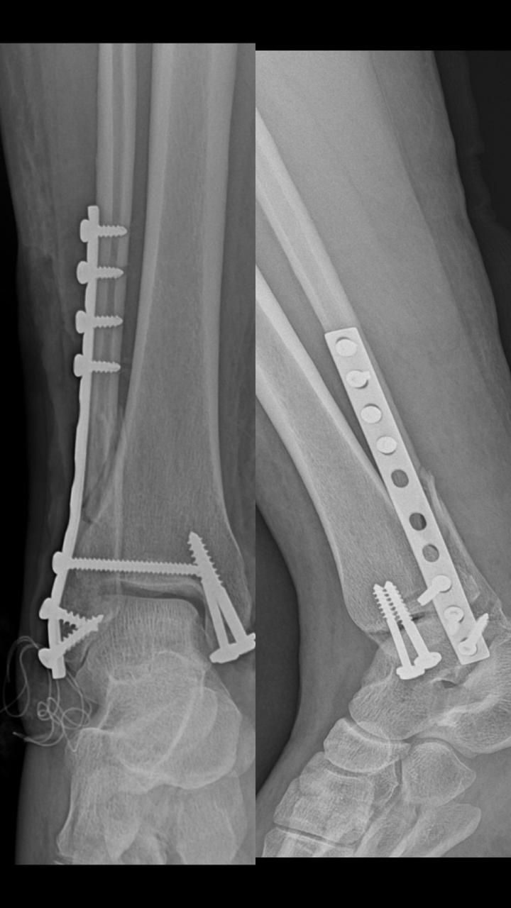 Carlos Humberto Vera Torres-0