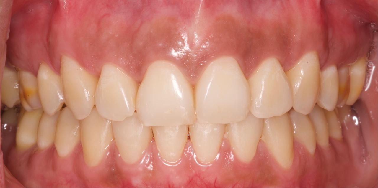 José Alberto Martínez Basulto-22