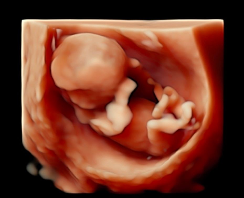 Zabdy Shirel H. Lascurain-24