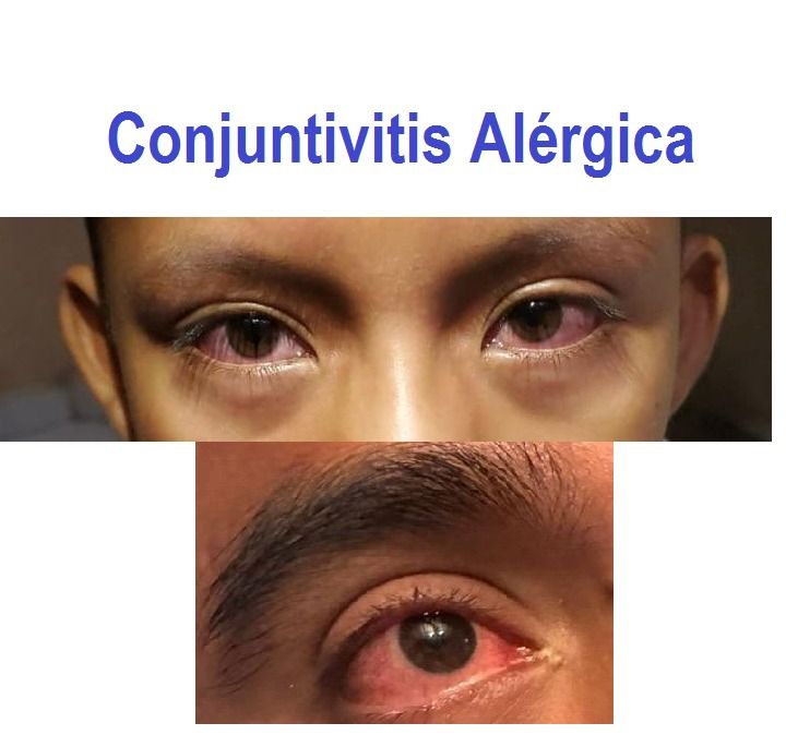 Nadia Tapia Pastrana-3