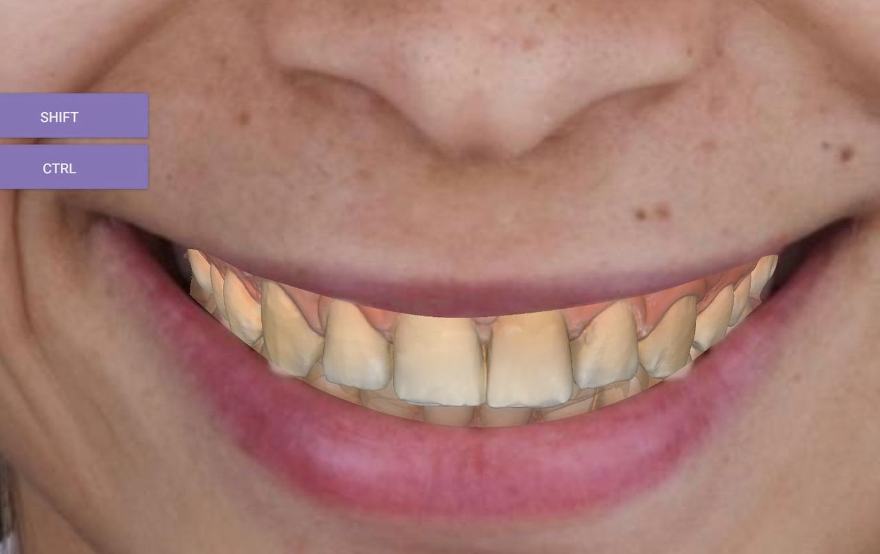 Fredy Alejandro Roblero Gónzalez-29