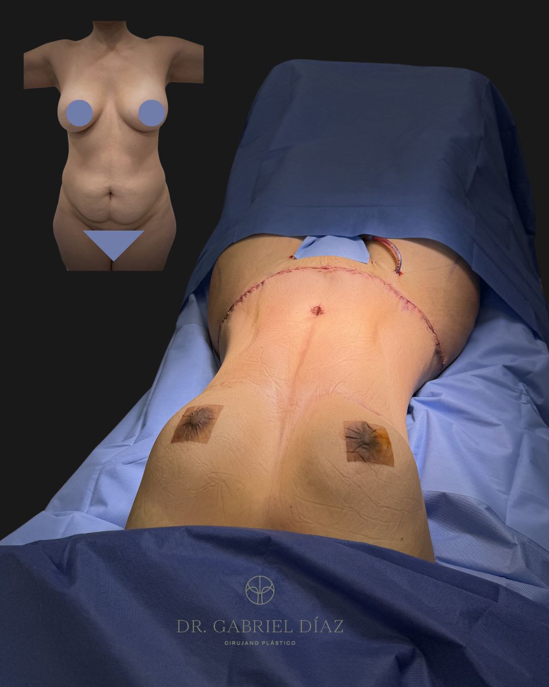 Gabriel Diaz Rosas-4