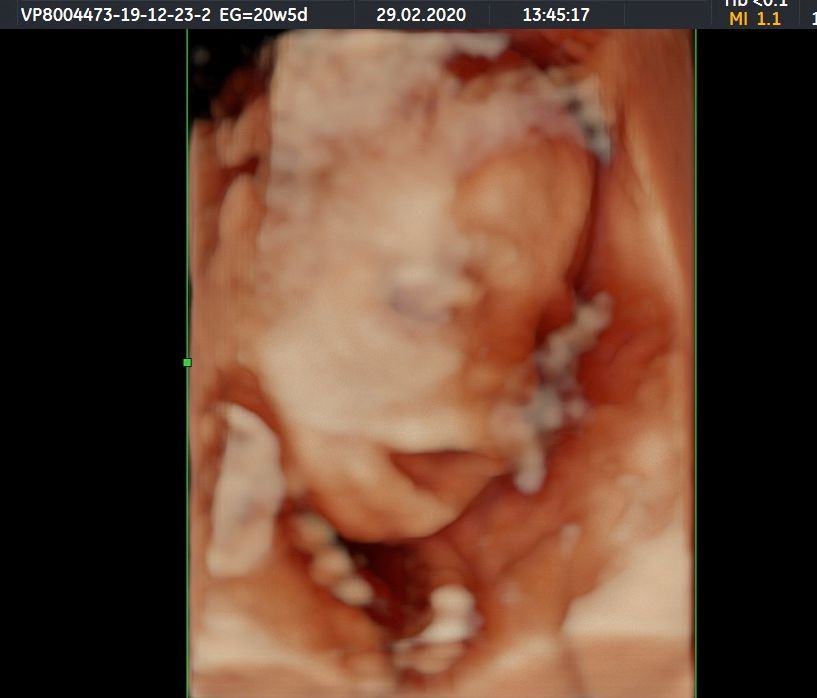 Susele Lara Rodríguez-1