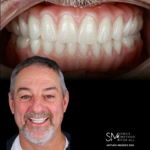 Arturo Mendez Valencia-21