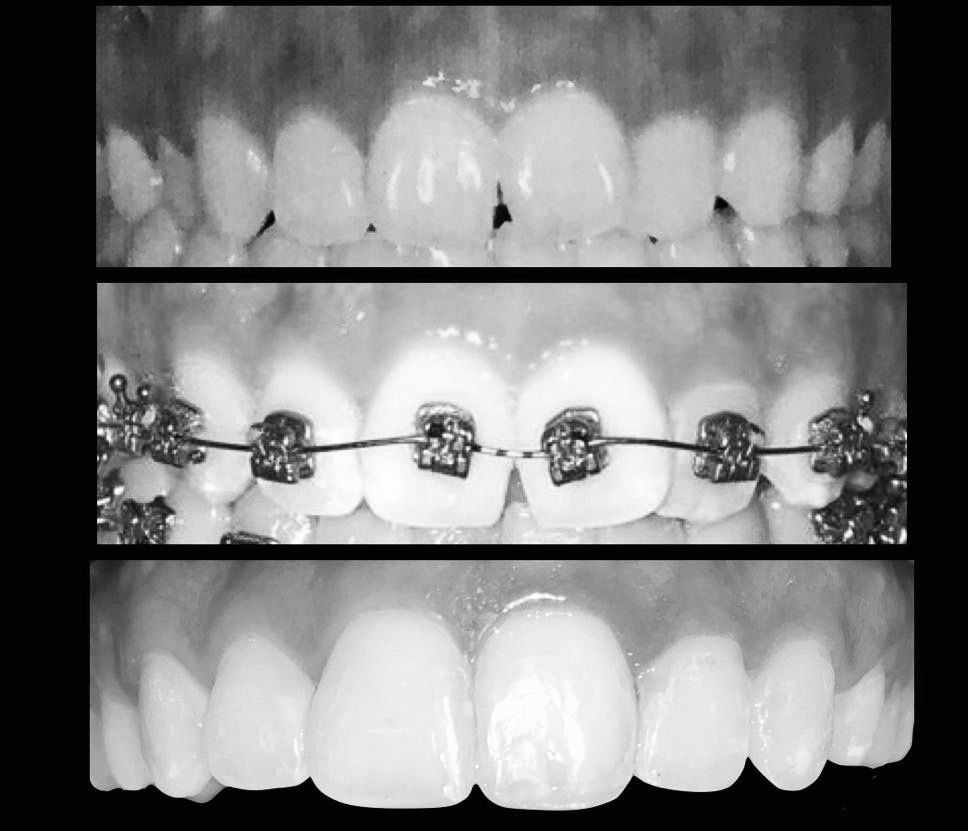 Zuriel Ayala Garcia-7